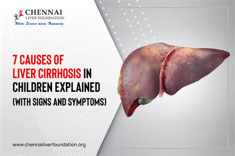 liverosis|Cirrhosis